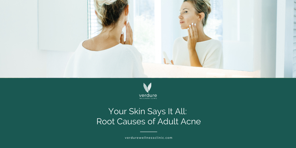 Your Skin Says it All: Root Causes of Adult Acne